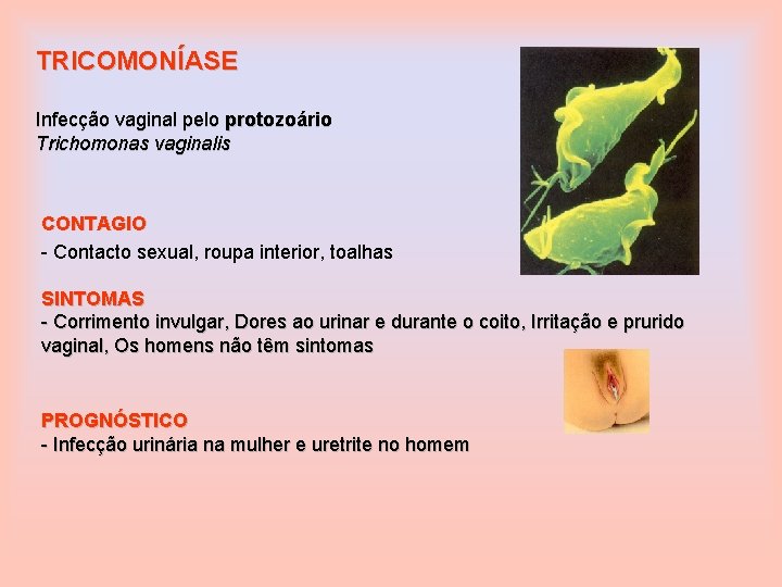 TRICOMONÍASE Infecção vaginal pelo protozoário Trichomonas vaginalis CONTAGIO - Contacto sexual, roupa interior, toalhas