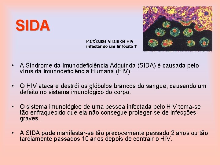 SIDA Partículas virais de HIV infectando um linfócito T • A Síndrome da Imunodeficiência