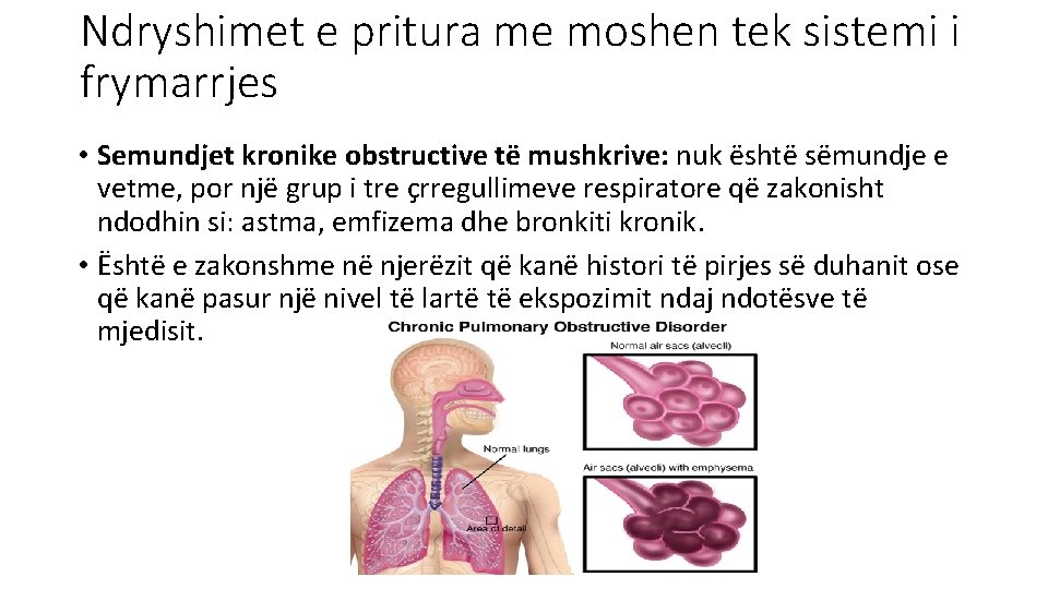 Ndryshimet e pritura me moshen tek sistemi i frymarrjes • Semundjet kronike obstructive të