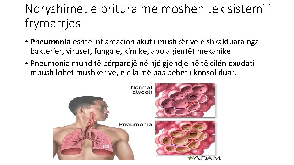 Ndryshimet e pritura me moshen tek sistemi i frymarrjes • Pneumonia është inflamacion akut