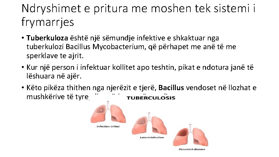 Ndryshimet e pritura me moshen tek sistemi i frymarrjes • Tuberkuloza është një sëmundje