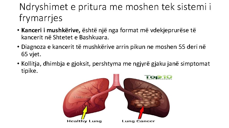 Ndryshimet e pritura me moshen tek sistemi i frymarrjes • Kanceri i mushkërive, është