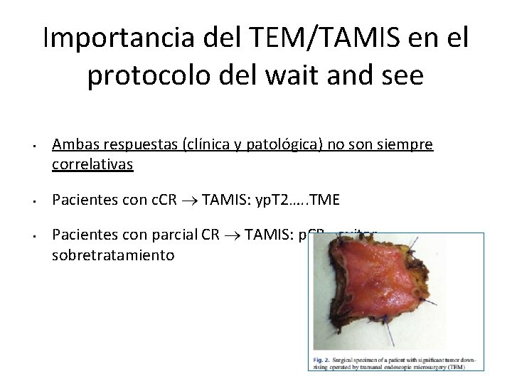 Importancia del TEM/TAMIS en el protocolo del wait and see • • • Ambas