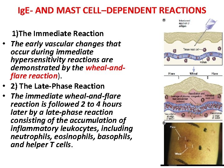 Ig. E- AND MAST CELL–DEPENDENT REACTIONS 1)The Immediate Reaction • The early vascular changes