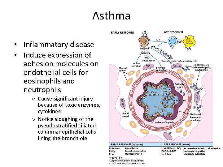 Asthma • Inflammatory disease • Induce expression of adhesion molecules on endothelial cells for