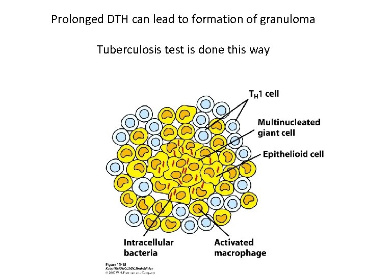 Prolonged DTH can lead to formation of granuloma Tuberculosis test is done this way