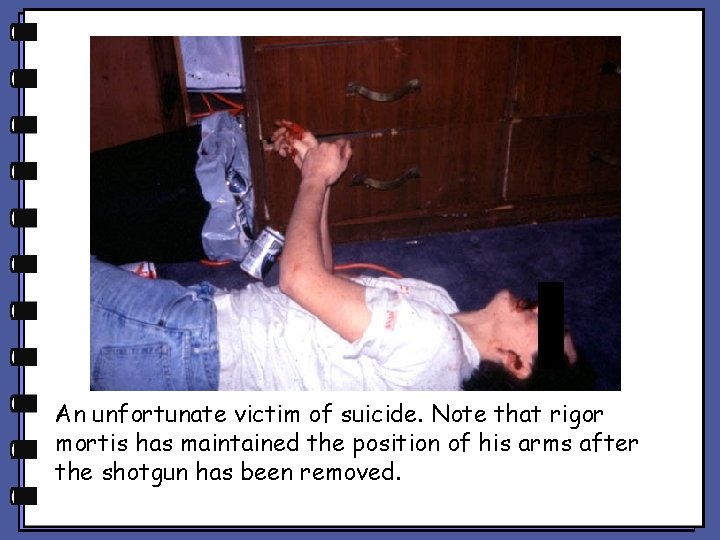 An unfortunate victim of suicide. Note that rigor mortis has maintained the position of