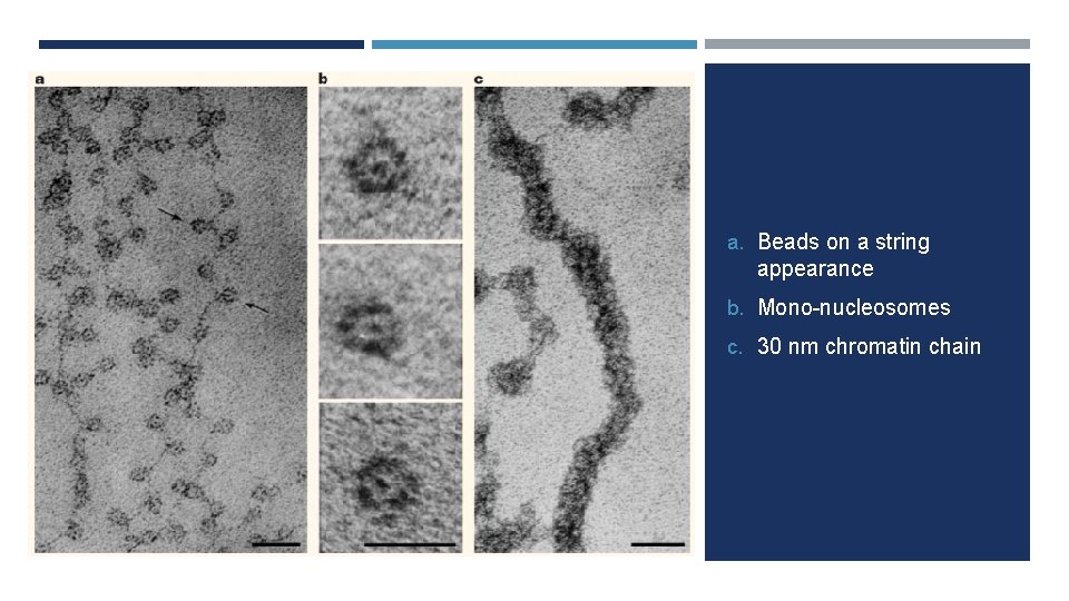 a. Beads on a string appearance b. Mono-nucleosomes c. 30 nm chromatin chain 