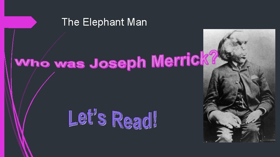 The Elephant Man 