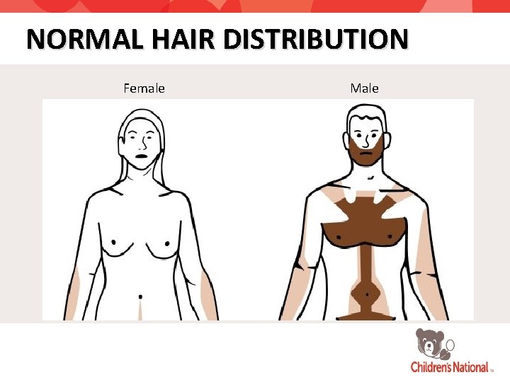 NORMAL HAIR DISTRIBUTION Female Male 