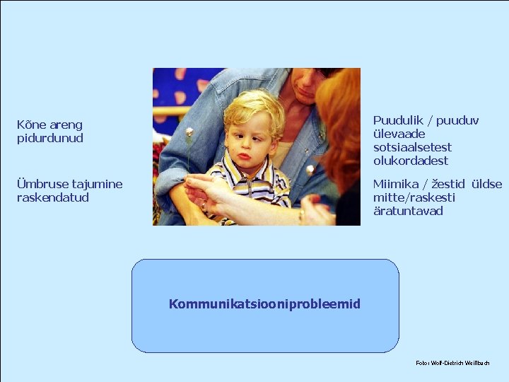 Kõne areng pidurdunud Puudulik / puuduv ülevaade sotsiaalsetest olukordadest Ümbruse tajumine raskendatud Miimika /