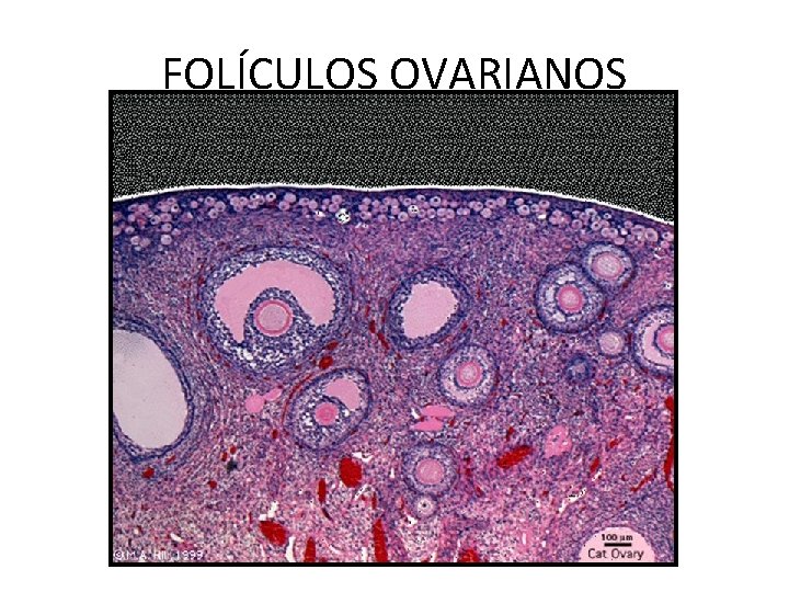 FOLÍCULOS OVARIANOS 