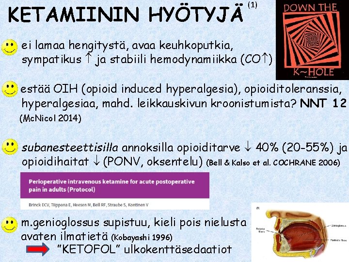 KETAMIININ HYÖTYJÄ (1) ei lamaa hengitystä, avaa keuhkoputkia, sympatikus ja stabiili hemodynamiikka (CO )