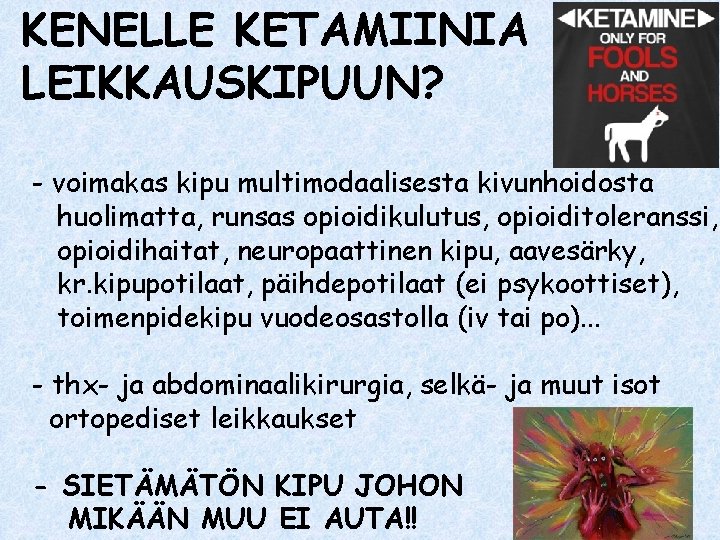 KENELLE KETAMIINIA LEIKKAUSKIPUUN? - voimakas kipu multimodaalisesta kivunhoidosta huolimatta, runsas opioidikulutus, opioiditoleranssi, opioidihaitat, neuropaattinen