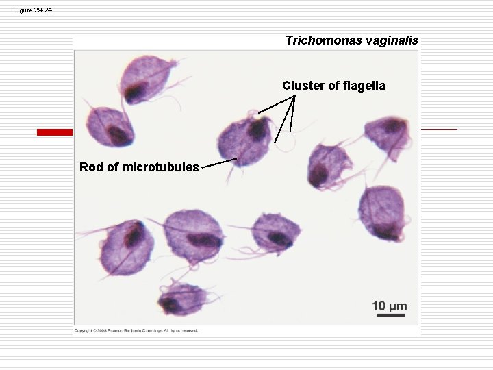 Figure 29 -24 Trichomonas vaginalis Cluster of flagella Rod of microtubules Figure 29 -24 Trichomonas vaginalis Cluster of flagella Rod of microtubules