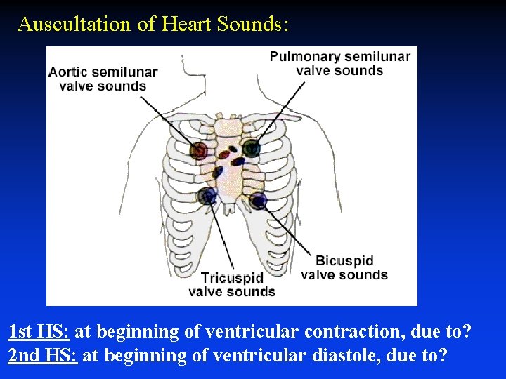 Auscultation of Heart Sounds: 1 st HS: at beginning of ventricular contraction, due to?