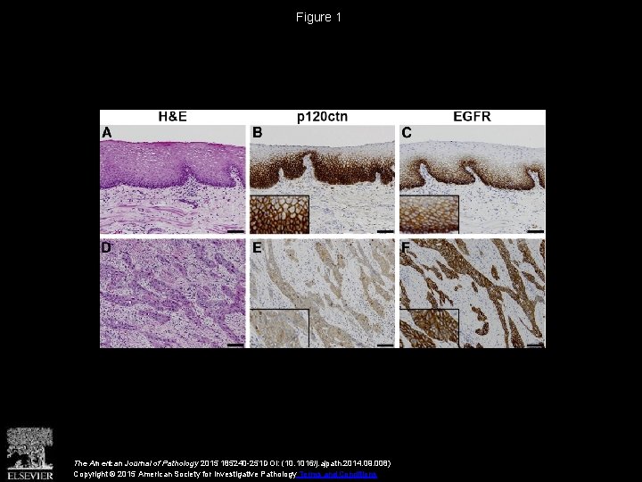 Figure 1 The American Journal of Pathology 2015 185240 -251 DOI: (10. 1016/j. ajpath.