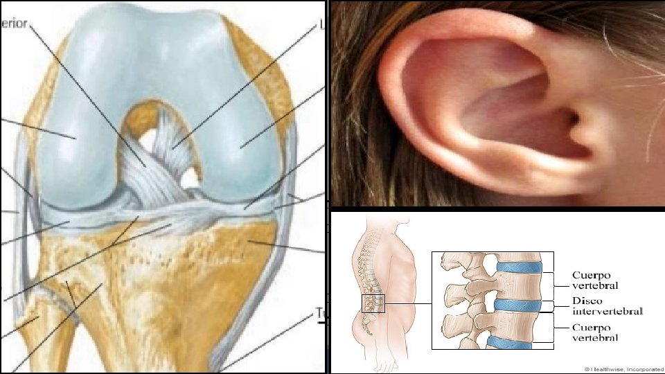 Ubicaciones • Cartílago hialino: esqueleto fetal, vías respiratorias, cartílagos nasales, cartílagos costales. • Cartílago