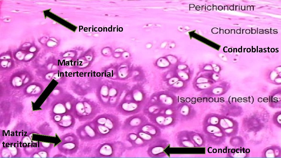 Pericondrio Matriz interterritorial Matriz territorial Condroblasto Matriz interterritorial Condroblastos Matriz territorial Condrocito 