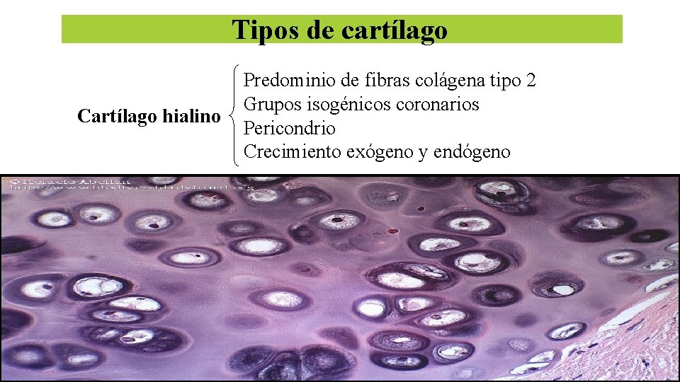 Tipos de cartílago Cartílago hialino Predominio de fibras colágena tipo 2 Grupos isogénicos coronarios