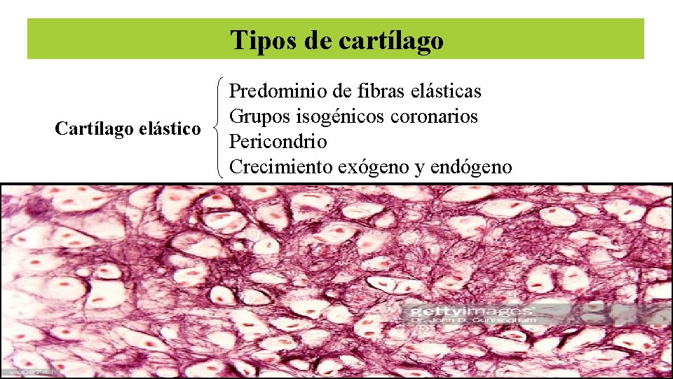 Tipos de cartílago Cartílago elástico Predominio de fibras elásticas Grupos isogénicos coronarios Pericondrio Crecimiento