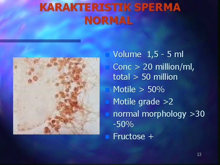 KARAKTERISTIK SPERMA NORMAL n n n Volume 1, 5 - 5 ml Conc >