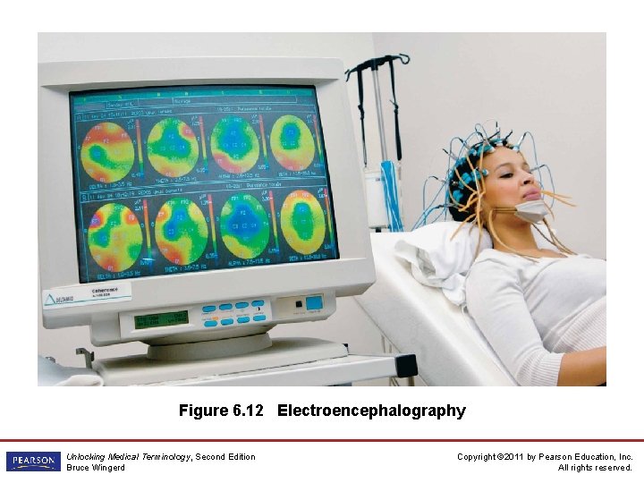 Figure 6. 12 Electroencephalography Unlocking Medical Terminology, Second Edition Bruce Wingerd Copyright © 2011