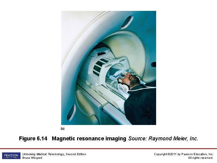 Figure 6. 14 Magnetic resonance imaging Source: Raymond Meier, Inc. Unlocking Medical Terminology, Second