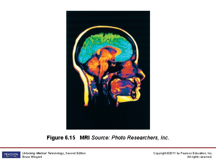 Figure 6. 15 MRI Source: Photo Researchers, Inc. Unlocking Medical Terminology, Second Edition Bruce