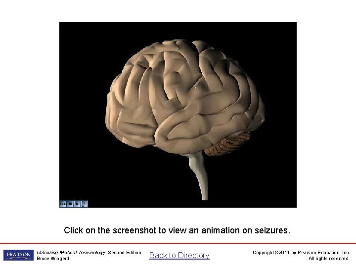 Seizures animation Click on the screenshot to view an animation on seizures. Unlocking Medical Seizures animation Click on the screenshot to view an animation on seizures. Unlocking Medical
