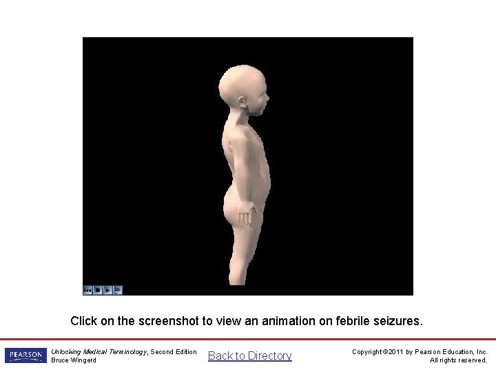 Febrile seizures animation Click on the screenshot to view an animation on febrile seizures. Febrile seizures animation Click on the screenshot to view an animation on febrile seizures.