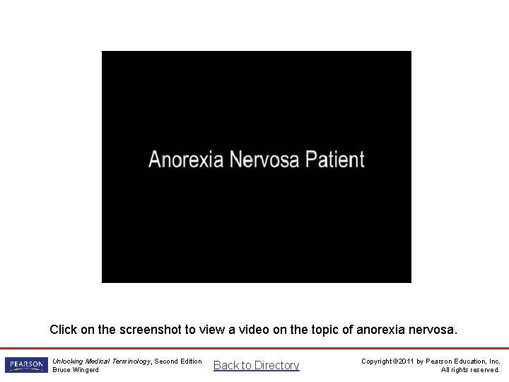 Anorexia video Click on the screenshot to view a video on the topic of