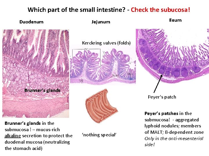 Which part of the small intestine? - Check the subucosa! Duodenum Jejunum Ileum Kerckring