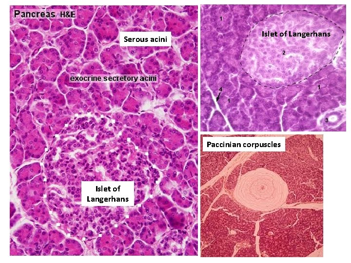 Serous acini Islet of Langerhans Paccinian corpuscles Islet of Langerhans 