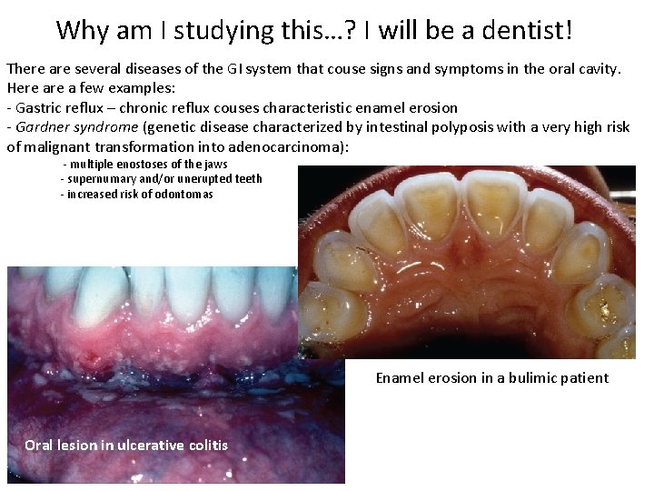 Why am I studying this…? I will be a dentist! There are several diseases