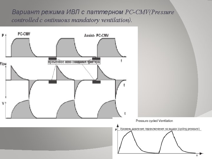 Вариант режима ИВЛ с паттерном PC-CMV(Pressure controlled c ontinuous mandatory ventilation). 