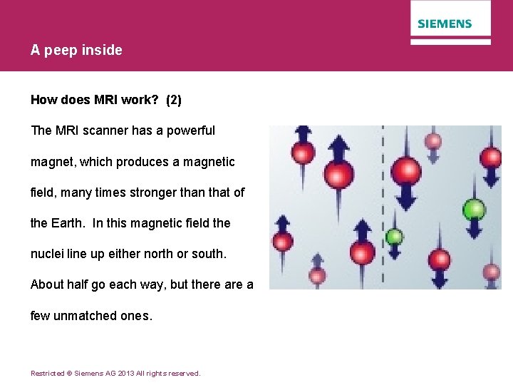 A peep inside How does MRI work? (2) The MRI scanner has a powerful