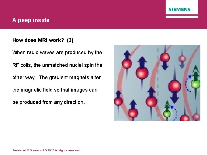 A peep inside How does MRI work? (3) When radio waves are produced by