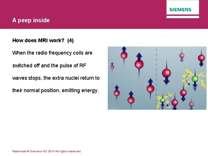 A peep inside How does MRI work? (4) When the radio frequency coils are