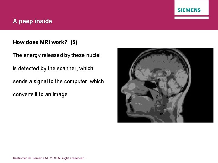 A peep inside How does MRI work? (5) The energy released by these nuclei