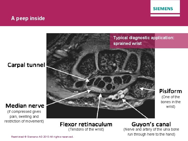 A peep inside Typical diagnostic application: sprained wrist (One of the bones in the