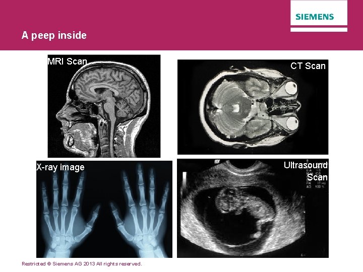 A peep inside MRI Scan X-ray image Restricted © Siemens AG 2013 All rights