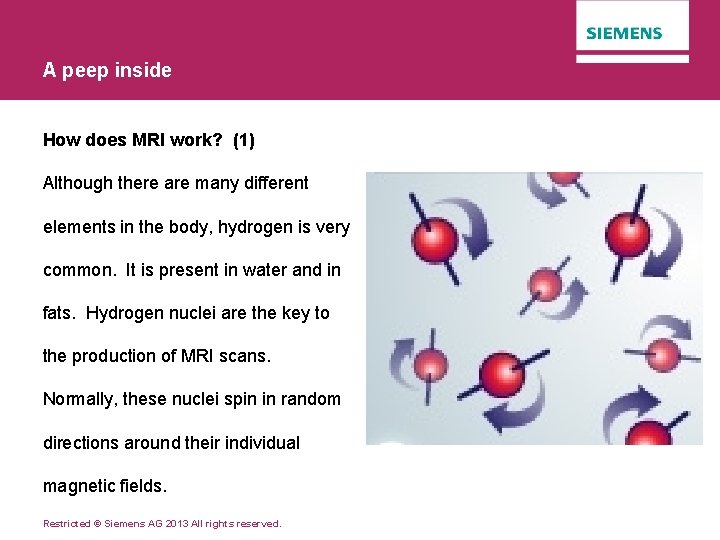 A peep inside How does MRI work? (1) Although there are many different elements