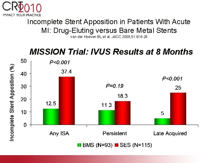 Incomplete Stent Apposition in Patients With Acute MI: Drug-Eluting versus Bare Metal Stents van