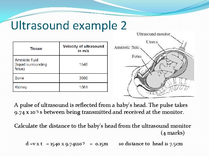 Ultrasound example 2 A pulse of ultrasound is reflected from a baby’s head. The