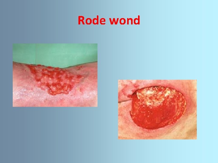 Rode wond 