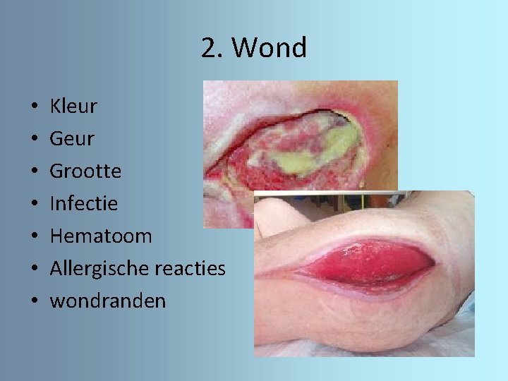 2. Wond • • Kleur Grootte Infectie Hematoom Allergische reacties wondranden 