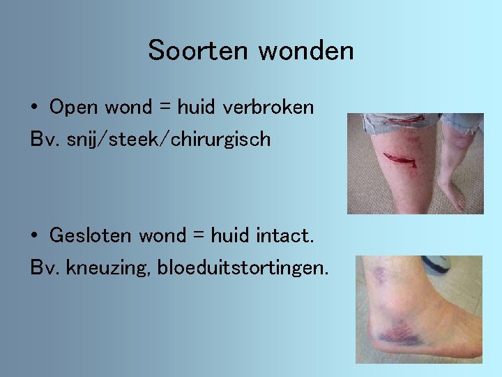 Soorten wonden • Open wond = huid verbroken Bv. snij/steek/chirurgisch • Gesloten wond =