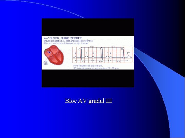 Bloc AV gradul III 