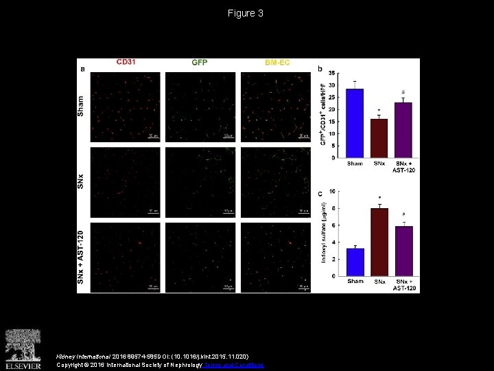 Figure 3 Kidney International 2016 89574 -585 DOI: (10. 1016/j. kint. 2015. 11. 020)